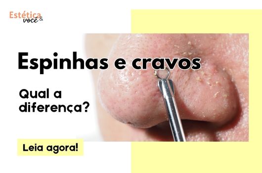 EEV - Espinhas e cravos - capa